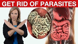 9 Tips to Get Rid of Parasites amp Candida  Dr Janine [upl. by Drofliw]