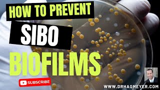 SIBO and Biofilms Why Biofilm Disruptors Are So Important When You Have SIBO [upl. by Nirrek]