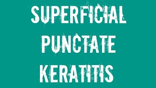 Ophthalmology Superficial punctate keratitis [upl. by Hebel819]