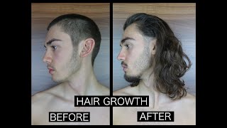 HAIR GROWTH TIME LAPSE  SIDE [upl. by Leaj]