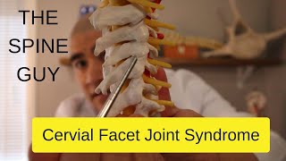 Cervical Facet Joint Syndrome [upl. by Lipkin]