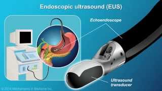 Understanding EUSFNA [upl. by Ymme880]