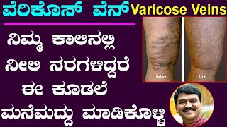 Varicose Veins Treatment in Kannada  Ayurveda tips in Kannada  Media Master  ಕಾಲಿನಲ್ಲಿ ನೀಲಿ ನರಗಳು [upl. by Anitnas659]