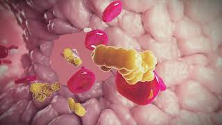 Complete Blood Count  CBC Interpretation Leukocytosis [upl. by Lechner]