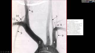 What is Angiography and Angiogram  How Angiography is performed 3D Animation [upl. by Spiegel]