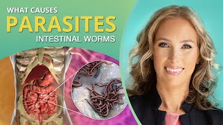 What Causes Parasites  Intestinal Worms  Dr J9 Live [upl. by Dleifyar]