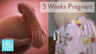 5 Weeks Pregnant What You Need To Know  Channel Mum [upl. by Ecinehs]