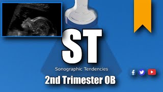 2nd Trimester OB scan [upl. by Lindon279]