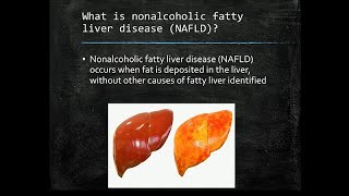 Fatty Liver The Silent Epidemic [upl. by Zeuqcaj]