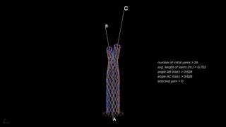 Braid Bifurcation [upl. by Monahan]