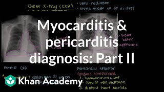 Diagnosis of myocarditis and pericarditis part 2  NCLEXRN  Khan Academy [upl. by Imogen]