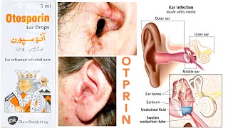 Otosporin Ear Drops Uses in Urdu Hindi [upl. by Tonjes]