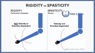 Rigidity vs Spasticity Explained [upl. by Eentirb964]