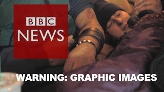 BBC goes undercover inside Americas heroin epidemic  BBC News [upl. by Noxaj]