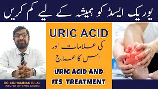 Uric Acid Ka Ilaj  Uric Acid Treatment in Urdu Hindi [upl. by Philemol515]