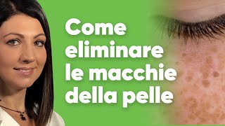 Come eliminare le macchie della pelle [upl. by Ilam]