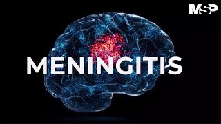 Meningitis [upl. by Nottap]