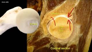 How to Don and Doff a Cervical Collar [upl. by Yrocaj]