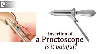 Purpose of proctoscopy How will a doctor insert a Proctoscope  Dr Rajasekhar M R [upl. by Brecher]