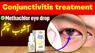 Methachlor eye drops  treatment of conjunctivitis [upl. by Mini]