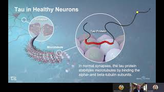 Targeting Tau in Alzheimers Disease [upl. by Hpeseoj90]