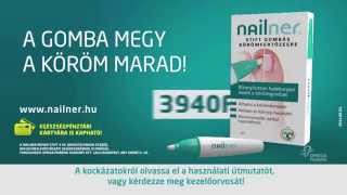 Nailner commercial  Hungary [upl. by Dee341]