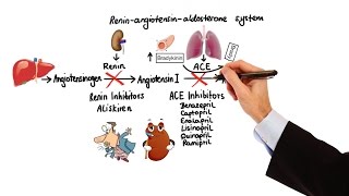 Pharmacology  HYPERTENSION amp ANTIHYPERTENSIVES MADE EASY [upl. by Palumbo]