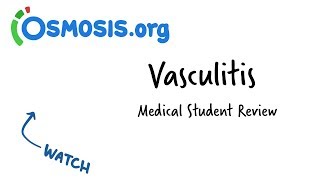 Vasculitis  Clinical Presentation [upl. by Conway369]