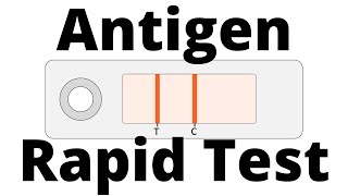 How SARSCoV2 Antigen Rapid Tests work Covid19 Testing [upl. by Dorahs]