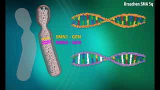 Erklärvideo Spinale Muskelatrophie SMA [upl. by Zoeller]
