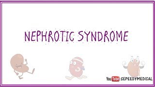 Nephrotic Syndrome Made Easy [upl. by Nwahsram509]