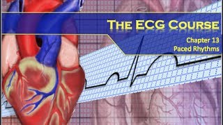 The ECG Course  Paced Rhythms [upl. by Kaycee]