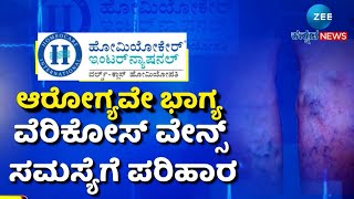 Homeopathic Treatment for Varicose veins  ನಿಮಗೂ ಕಾಡ್ತಿದೆಯಾ ವೆರಿಕೋಸ್‌ ವೇನ್ಸ್ ಸಮಸ್ಯೆ [upl. by Guinna508]