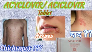 Acyclovir tablets  Herpikind  Herpikind Tablet  Zovirax  Zovirax tablets  uses side effects [upl. by Lowell]