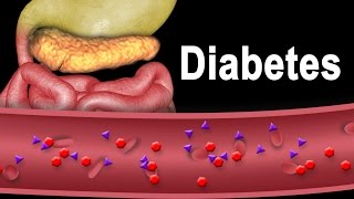 Diabetes Type 1 and Type 2 Animation [upl. by Cattima394]