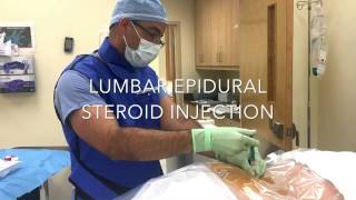 Epidural Steroid Injection Procedure by Eddy Feliz MD [upl. by Llenrev]