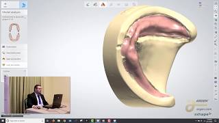 Digital Dentures A Crash Course on How to Design using 3Shape  Logan Woomer [upl. by Aryas]