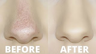 HOW TO STOP FOUNDATION RUBBING OFF YOUR NOSE  OILY SKIN TRICKS [upl. by Hsenid]