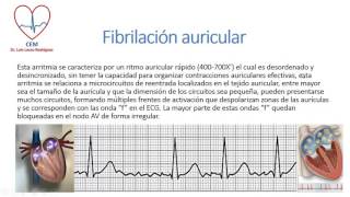 Aspectos electrocardiográficos de las arritmias supraventriculares [upl. by Ardme]