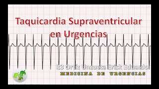 Taquicardia Supraventricular en Urgencias [upl. by Ycniuq]