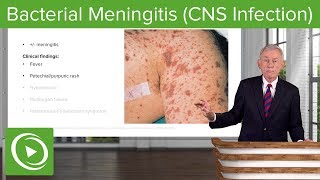 Bacterial Meningitis CNS Infection – Infectious Diseases  Lecturio [upl. by Yenruoc]