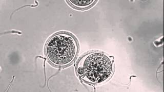 Interacting sperm and egg [upl. by Ahsilek]