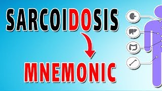 Sarcoidosis–What are my Treatment Options [upl. by Alwyn]