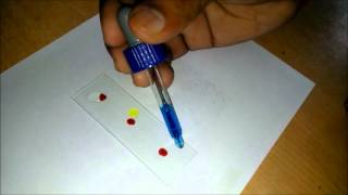 How To Test Your Own Blood Groups [upl. by Norford]