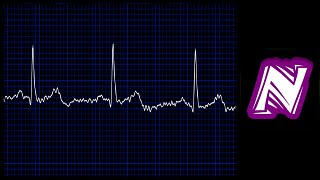 Sonido de monitor cardiaco  Heart monitor sound effect  Ekg sound  Sonido electrocardiograma [upl. by Igal]