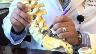 Surgical Procedures  Lumbar Laminectomy amp Discectomy [upl. by Lahsiv40]