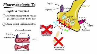 Migraines  Pathophysiology amp Treatment Described Concisely [upl. by Tiat251]