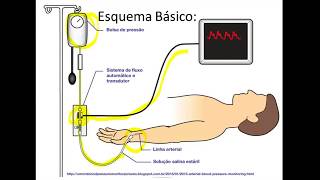 PAI Pressão Arterial Invasiva parte 1 [upl. by Bruyn]