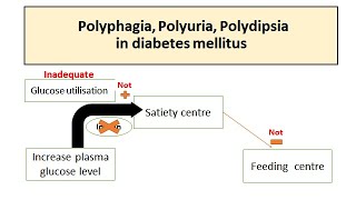 Polyuria Polyphagia Polydipsia in Diabetes mellitus [upl. by Hsara]