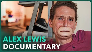 The Extraordinary Case of Alex Lewis [upl. by Aieki]